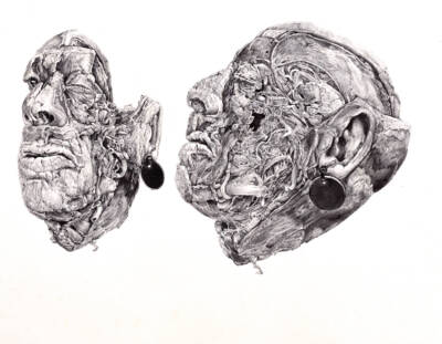 Head 2, Prosected Head 2 Views by Sonya G Peters