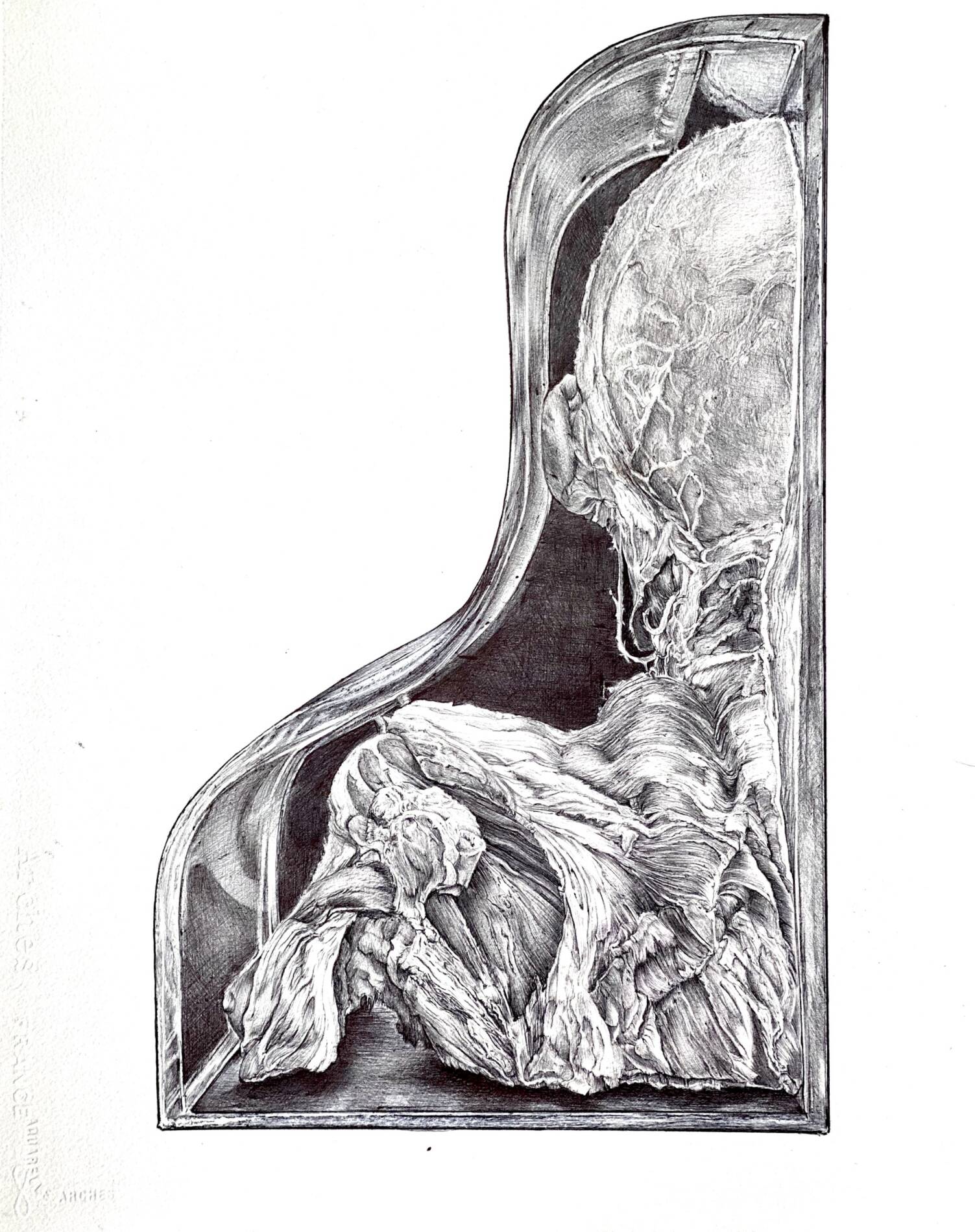 The Cadaver Museum, Head and Neck Specimen by Sonya G Peters, dark Drawings  for sale, direct from the artist